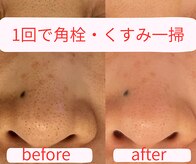 シュシュ(Chou Chou)