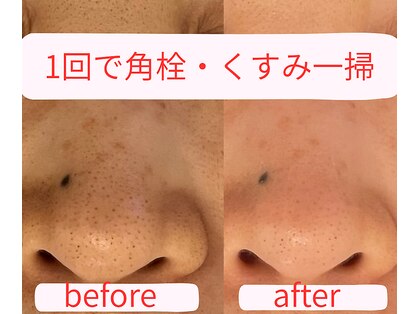 シュシュ(Chou Chou)の写真