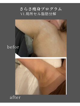 ナチュラル ビューティー スタイル さらさ(Natural Beauty Style)/さらさの独自技術