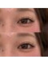 バニーアイズ 天神(Bunny eyes TENJIN)/ワンホンデザイン140本