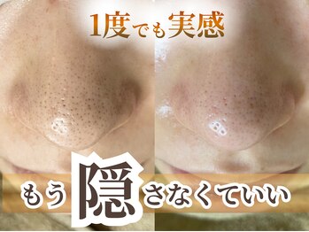 ウィル 二子新地(will)の写真/何をしても改善しなかった、大人の毛穴悩みに向き合う本気ケア