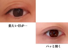 スピラーレ(Spirare)の雰囲気（眼精疲労に対しての目パック。一度ご体感ください。）