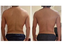 レヴィ(Revie)の雰囲気（華奢で女性らしい後ろ姿へ変わりましょう。）