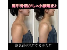 オーラ 美容サロン(AURA)の雰囲気（整体付でお悩みを根本から解消！小顔＋首肩周りもスッキリ改善☆）