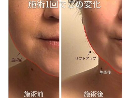 アイセ(AISE)の写真