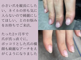 パラジェル深爪緩和クリアコース