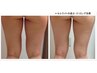 【むくみスッキリ美脚!】強力痩身ラフォス（脚・太もも）】¥2,980　　