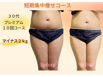 ヨサパーク リボーン(YOSA PARK Reborn)/劇的ビフォーアフター/痩身駒込