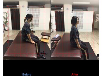 ストレチックス 近江八幡店/姿勢改善ビフォーアフター1回