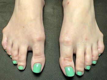 バレ(BARE)/シェラックワンカラー