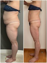 エミニー バイ エルズ(Eminy by L★s)/40代　セルゼロ全身　28 回