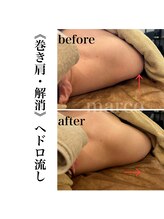 マルコ(marco)/ヘドロ流し