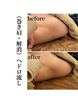 マルコ(marco)/ヘドロ流し