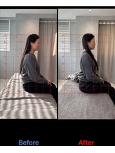 ミトノウ(MITONOU)/姿勢矯正