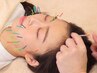 【美容鍼でたるみ改善】　トータルコース