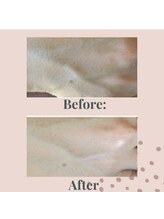 インフィニティ(INFINITY)/手の甲ケア♪