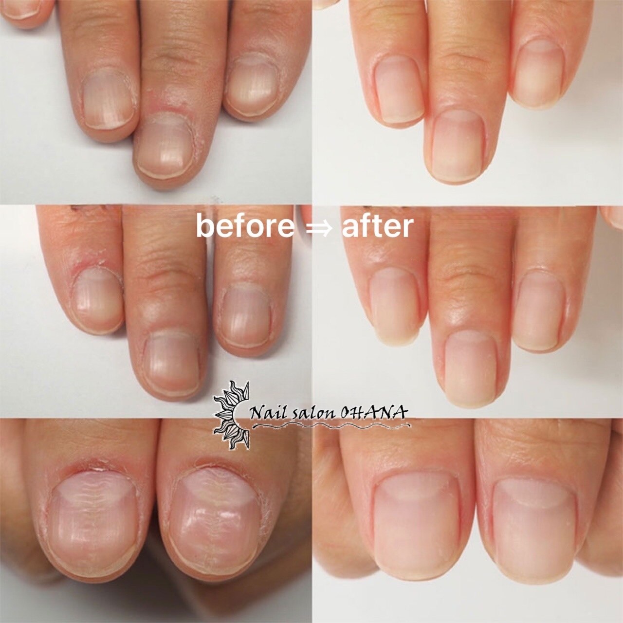 クーポン・メニュー｜オハナ(OHANA)｜ホットペッパービューティー