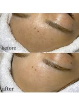 フィーネ アイブロウ(Fi-Ne)/ララピール（全顔）