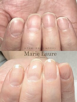 マリーロール 淀屋橋本店(Marie Laure)/自爪育成/深爪矯正/ネイルケア