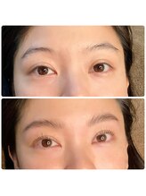 アズール 宮古島(AZUL)/パリジェンヌ＆ブロウリフト