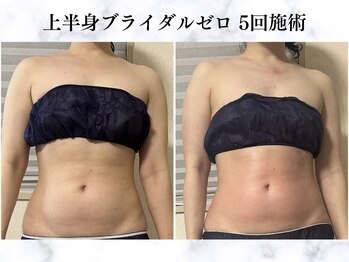 シーフェイス 横浜店(SEE FACE)/ブライダル痩身上半身ダイエット