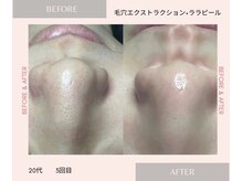 イーサロン(eii salon)の雰囲気（毛穴の汚れも引き締めも１度で見違える♪ララでハリツヤもアップ）