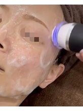 エヌフェイシャル(N.facial)/【炭酸導入】