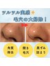 【毛穴の黒ずみ・ザラつき】"美容液でお肌を洗う" ハイドラ毛穴洗浄¥5,000