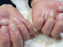 いろこびん 盛岡フェザン店(irokobin)/深爪矯正