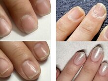 ネイルケアもフットケアも◎深爪