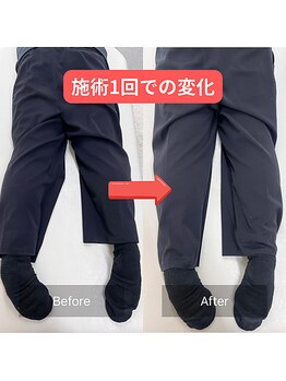 整体 寿 立川院(KOTOBUKI)/立川/整体/肩こり/腰痛/美容整体