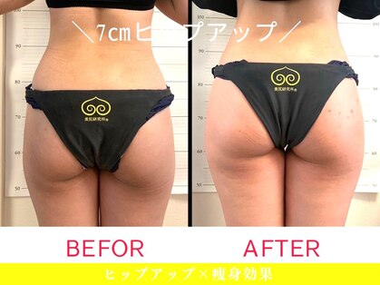 美尻研究所 麻布十番店の写真