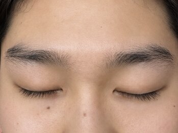 シェリー(Cherie)/before