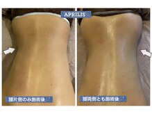 アプリリス(APRILIS)/くびれが欲しい方に♪