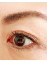 ヌーベルコピーヌ 2nd/顔全体脱毛コースで眉毛周りも○