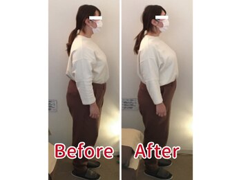 ほぐし屋さん/猫背の姿勢が一回でここまで変化