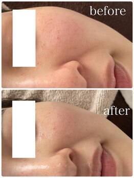 エミィシア(Emisia)/アンストレス