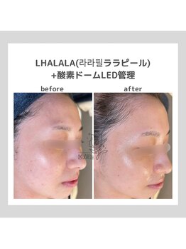 ポムハヌル(pom.haneul)/韓国肌管理室