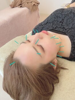 ヒーリングサロン アージュ(A-je)/★美顔鍼＋小顔矯正★