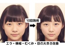 ニュートラル 渋谷店(NEUTRAL)の雰囲気（30代女性の変化［小顔/骨盤/渋谷］）