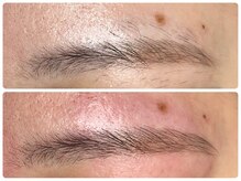 ダブルオー 銀座(00)/美容電気脱毛/眉毛脱毛