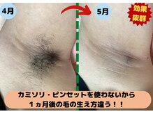 ディスイズミー シュガーリング(This is me Sugaring)