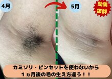 ディスイズミー シュガーリング(This is me Sugaring)