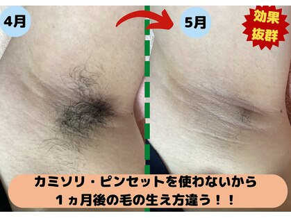 ディスイズミー シュガーリング(This is me Sugaring)の写真