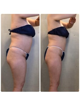 エクセレントビューティーサロン 艶(EN)/減量プログラム　６ｋｇ減量