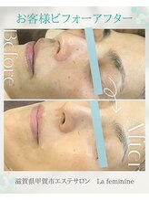 ラ フェミニン(La feminine)/ララピール＊50代モニター様