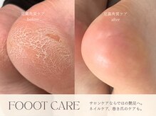 まつ毛エクステアンドネイル フィーカ 新松戸(FIKA)の雰囲気（大人気の足裏角質ケア。タコ・魚の目まで丁寧に取り除きます。）