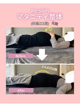リスリム(Re:slim)/産後のケアはいつから？