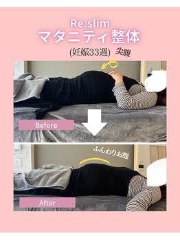 リスリム(Re:slim)/産後のケアはいつから?