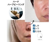 サロン エミニー 甲府(Eminy)の雰囲気（さまざまな施術の中からお客様にあった施術を組み合わせてご提案）